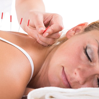 Acupuncture-616x361-1-removebg-preview